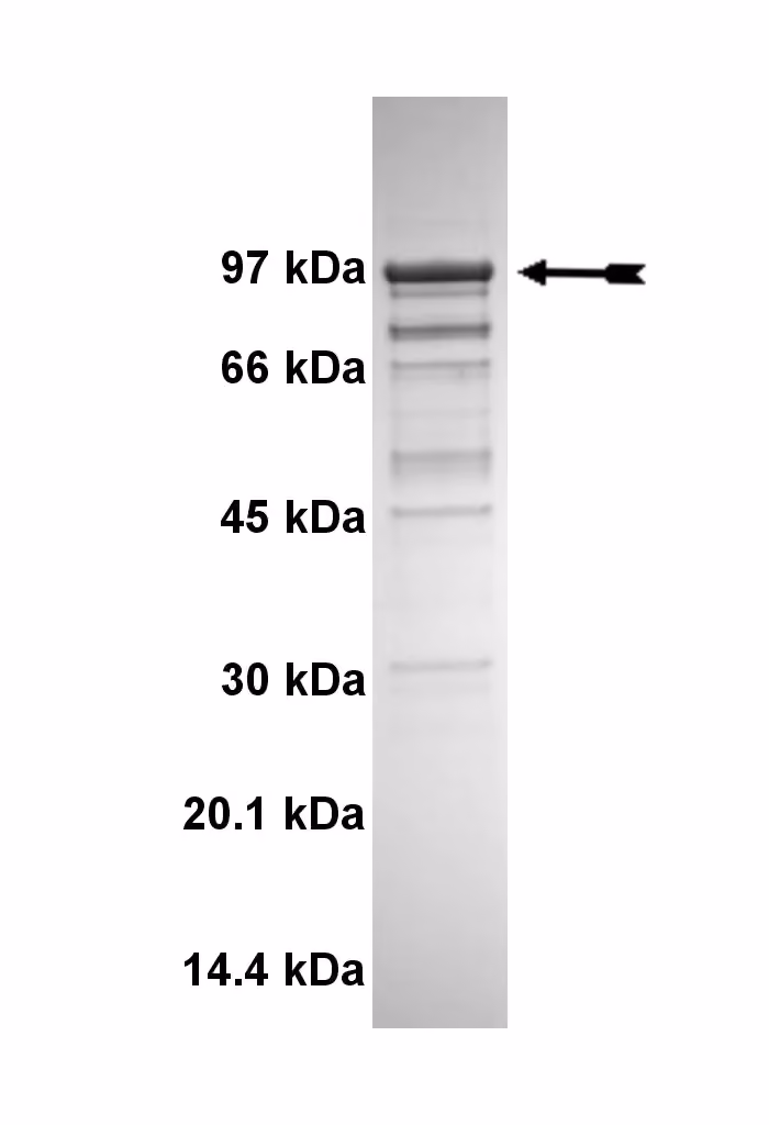 MARK1, active Human Recombinant Kinase Protein