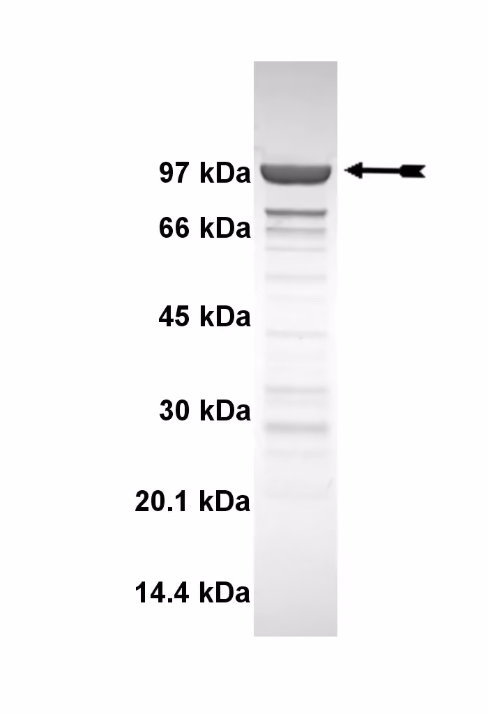 eEF-2K, active Human Recombinant Kinase Protein
