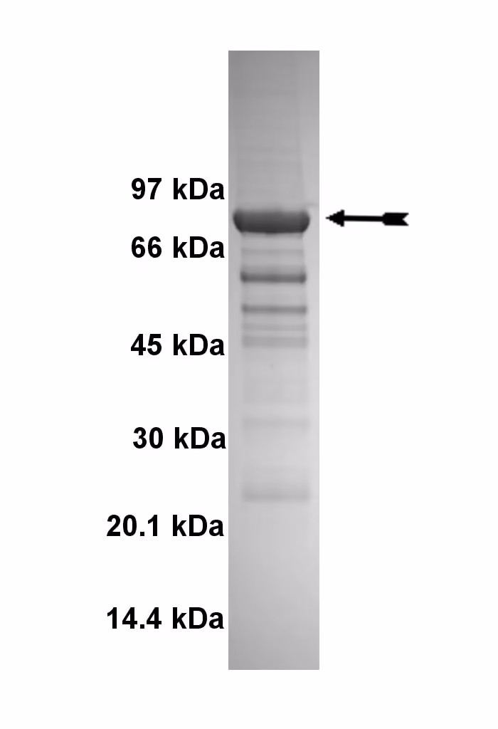 BrSK2, active Human Recombinant Kinase Protein