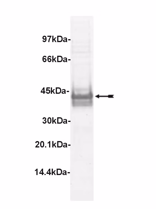 LIM Kinase 1, active Human Recombinant Kinase Protein