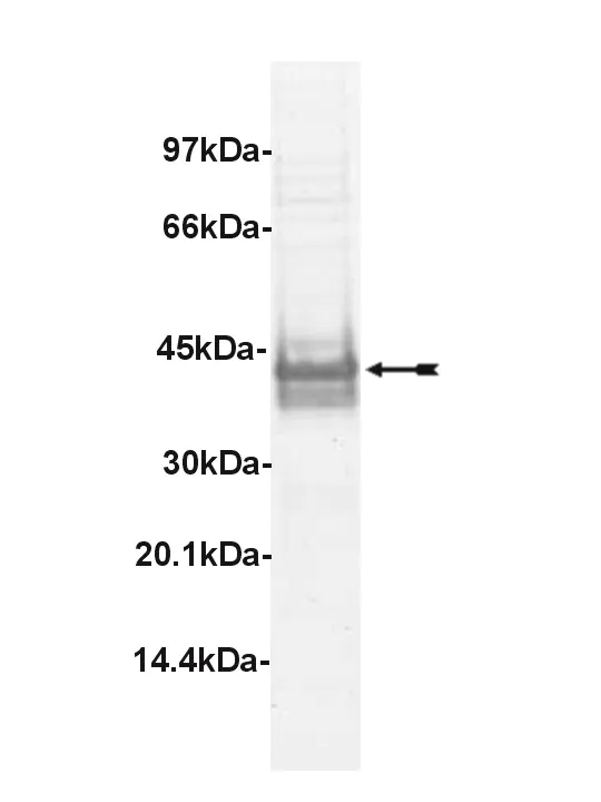 LIM Kinase 1, active Human Recombinant Kinase Protein