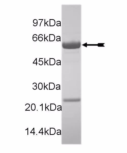Mer, active Human Recombinant Kinase Protein