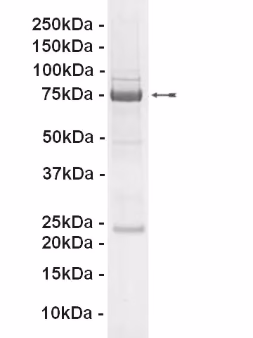 c-Kit (V560G), active Human Recombinant Kinase Protein