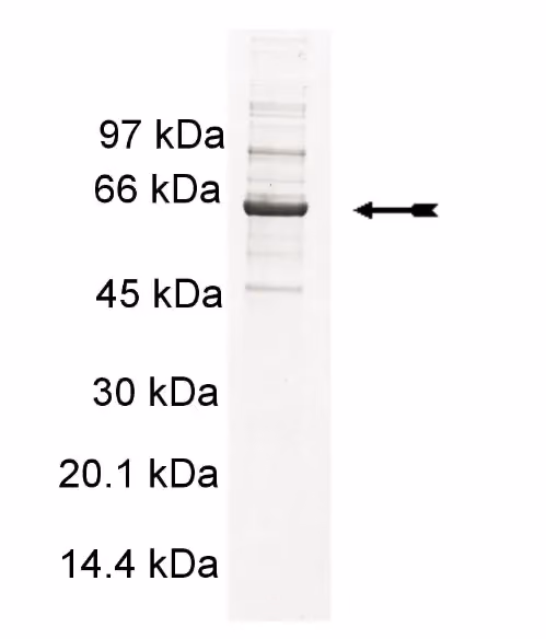 PDGFRα (550-end, V561D), active Human Recombinant Kinase Protein