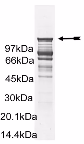 Abl (H396P), active Human Recombinant Kinase Protein
