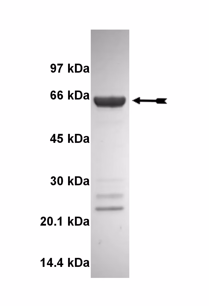 DAPK2, active Human Recombinant Kinase Protein