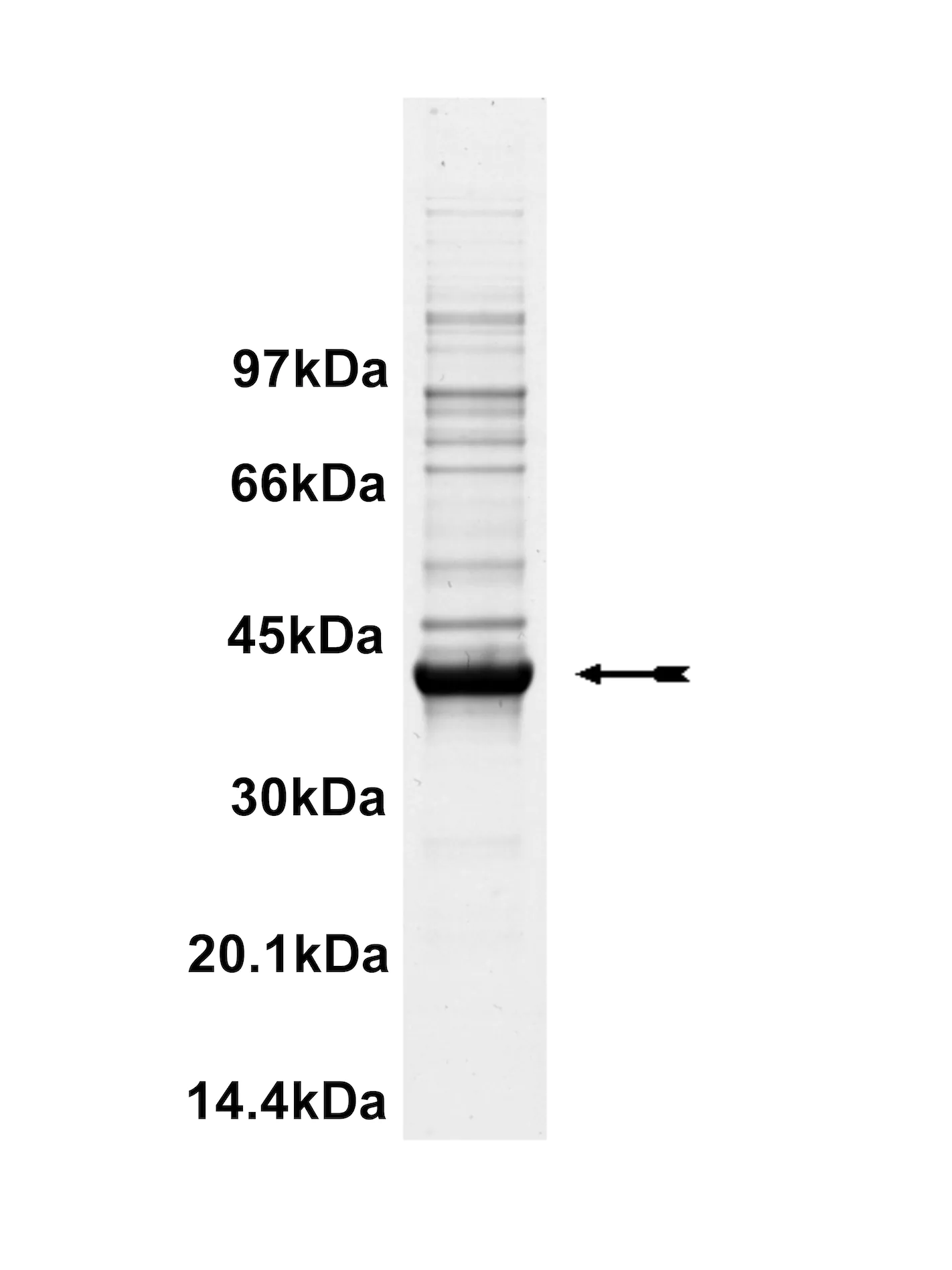 LIM Kinase 1, unactive Human Recombinant Kinase Protein
