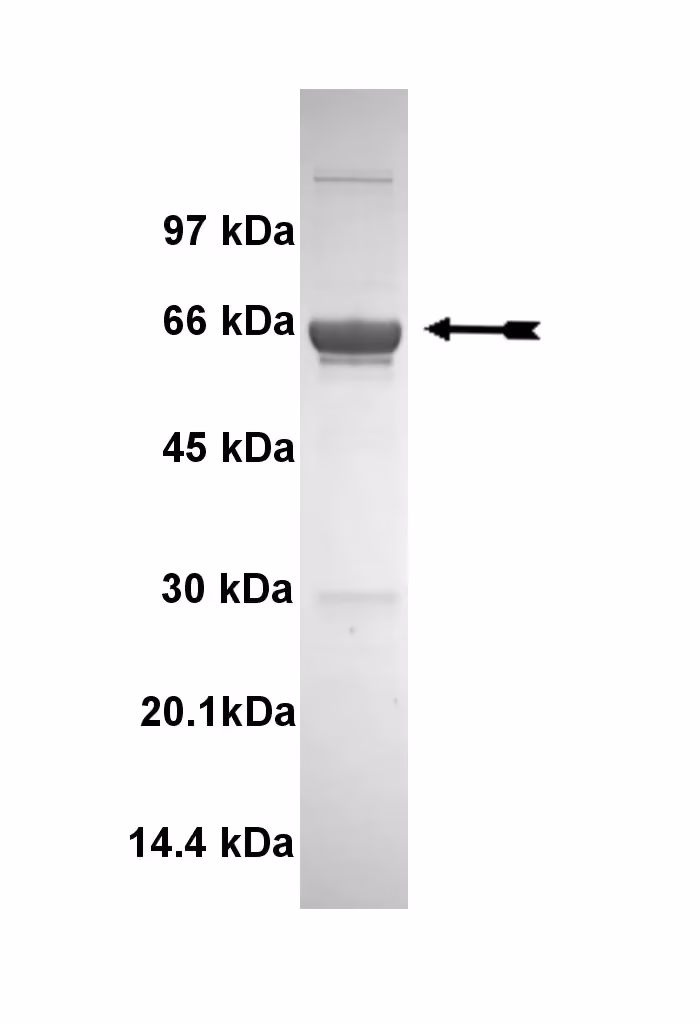 CaM Kinase I, active Human Recombinant Kinase Protein