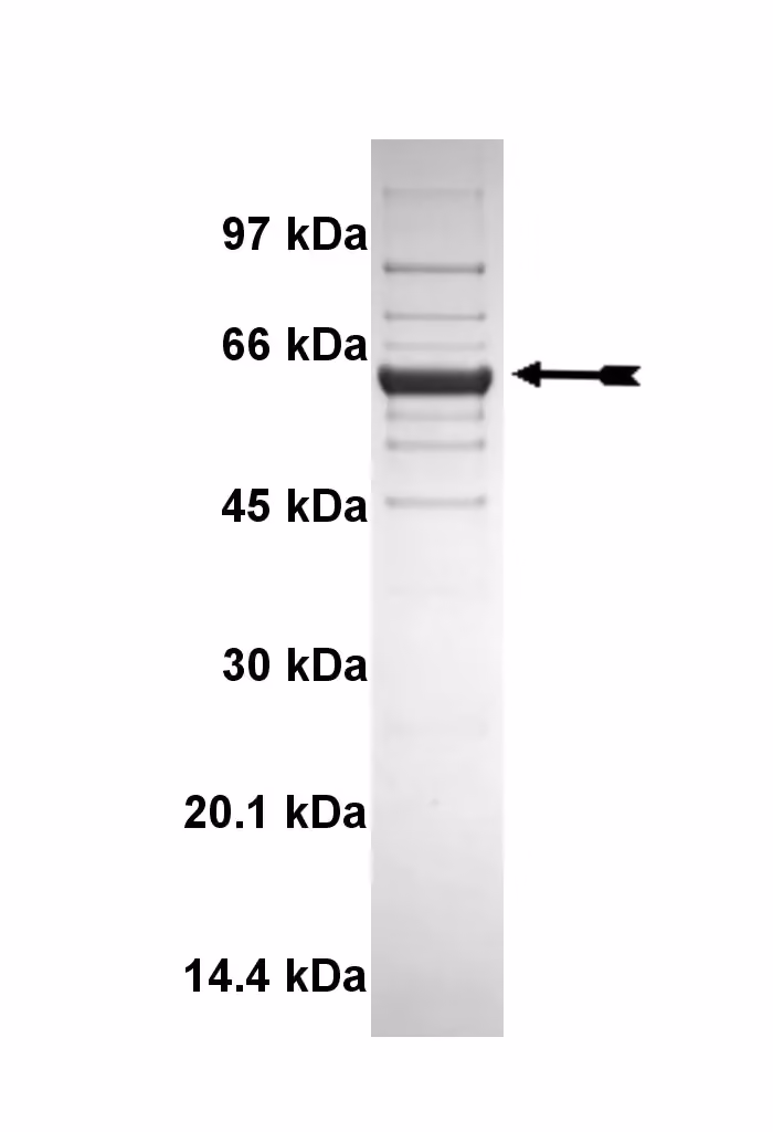 DYRK2, active Human Recombinant Kinase Protein
