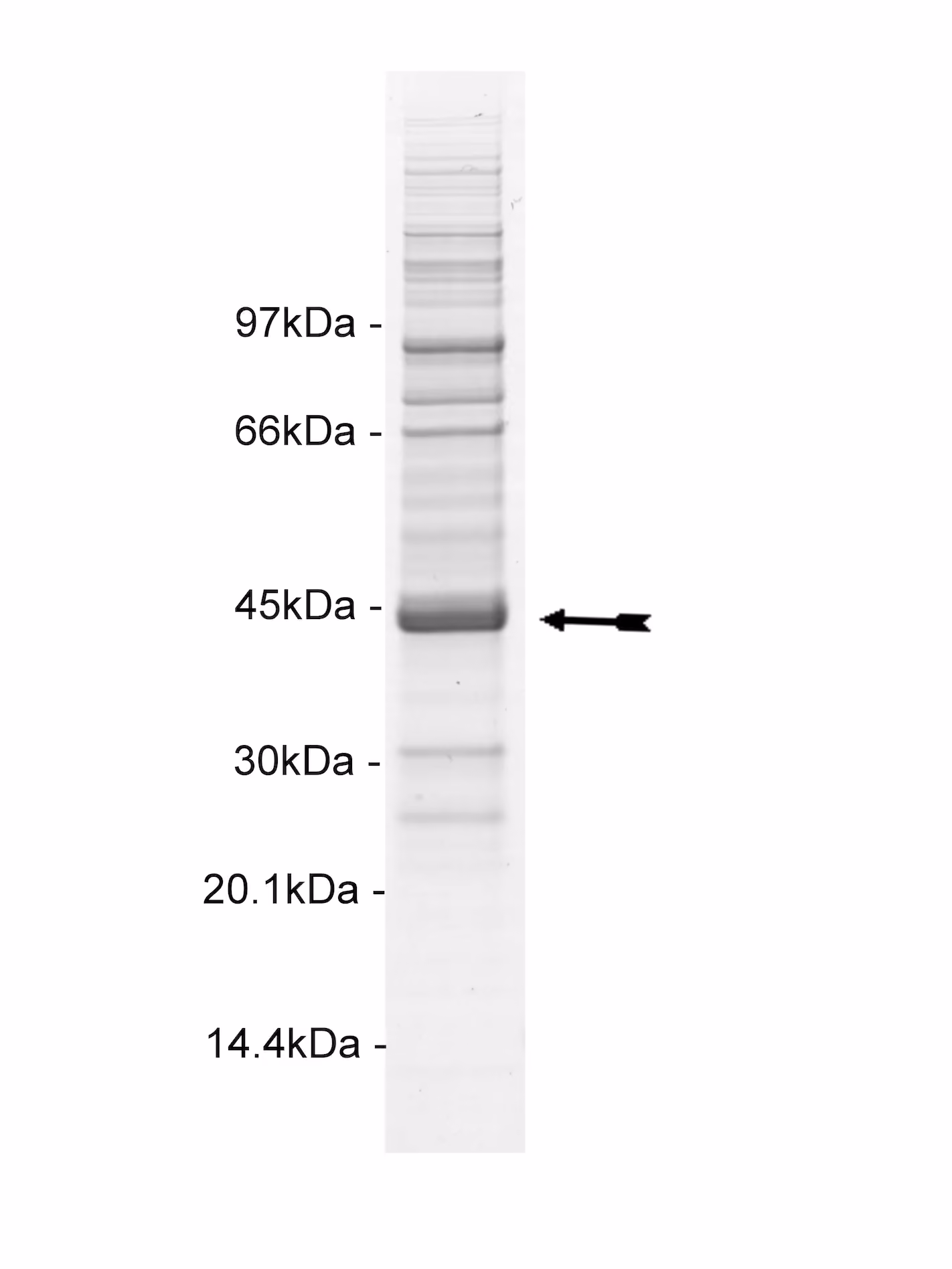 LOK, active Human Recombinant Kinase Protein