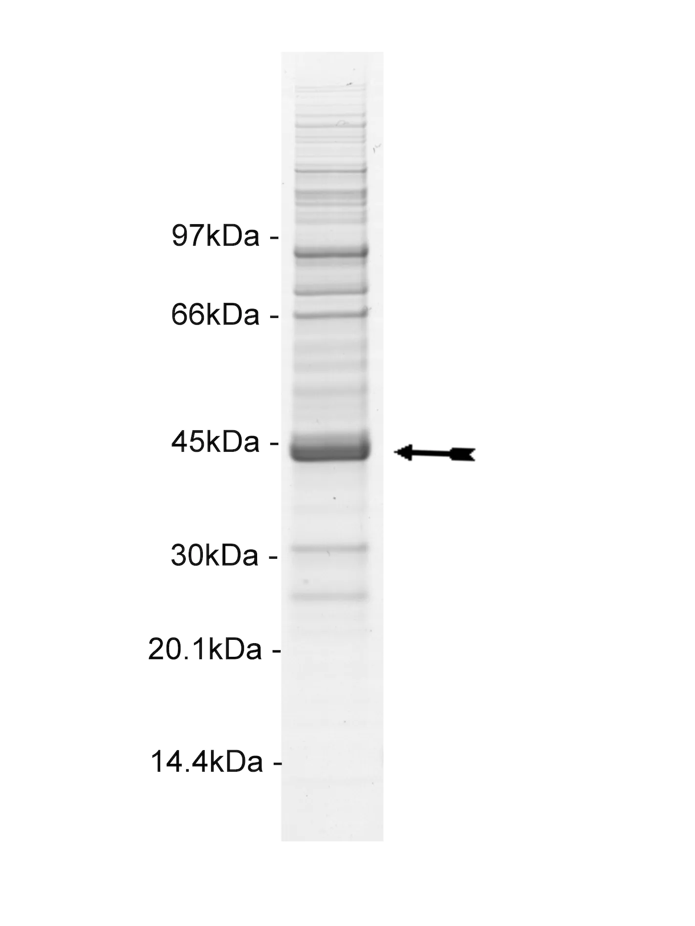 LOK, active Human Recombinant Kinase Protein