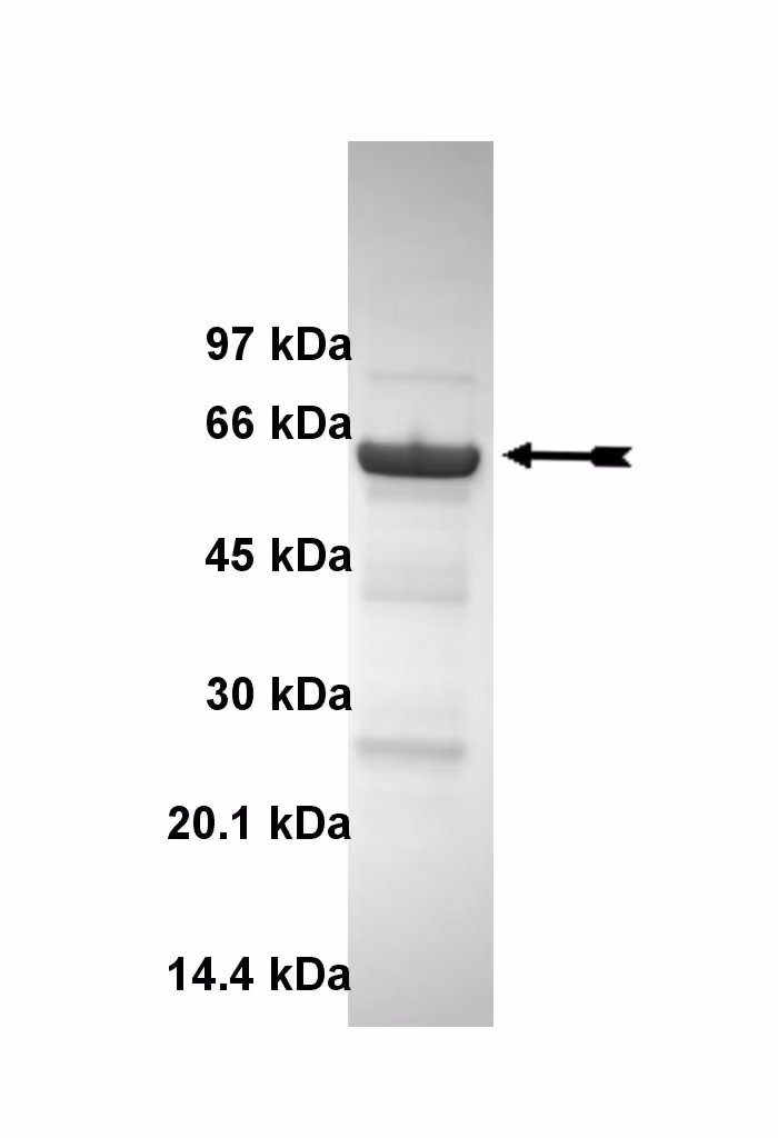 p38α/SAPK2a (T106M), active Human Recombinant Kinase Protein