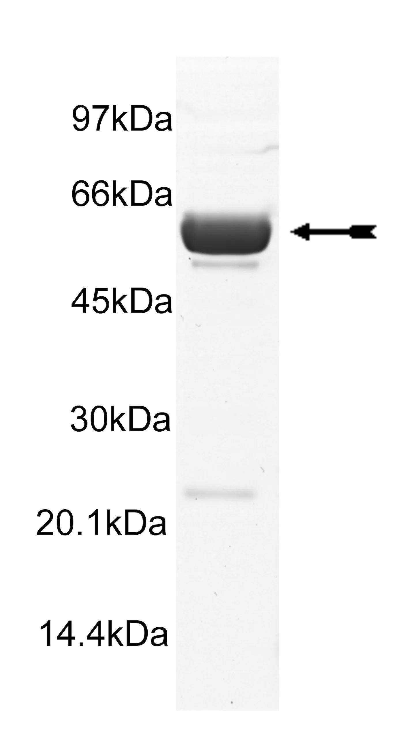 DAPK1, active Human Recombinant Kinase Protein