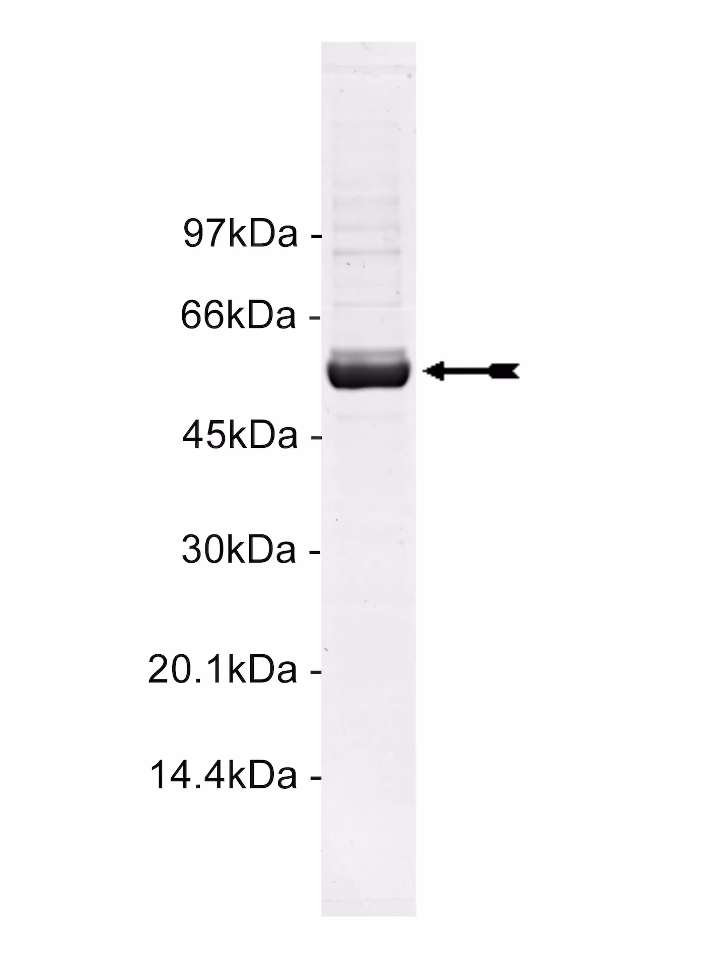 MRCKα, active Human Recombinant Kinase Protein