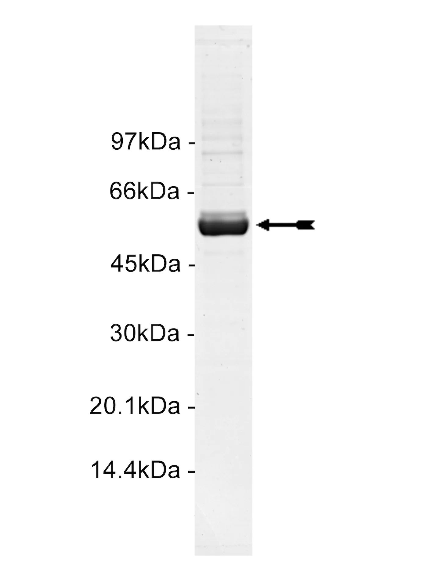 MRCKα, active Human Recombinant Kinase Protein