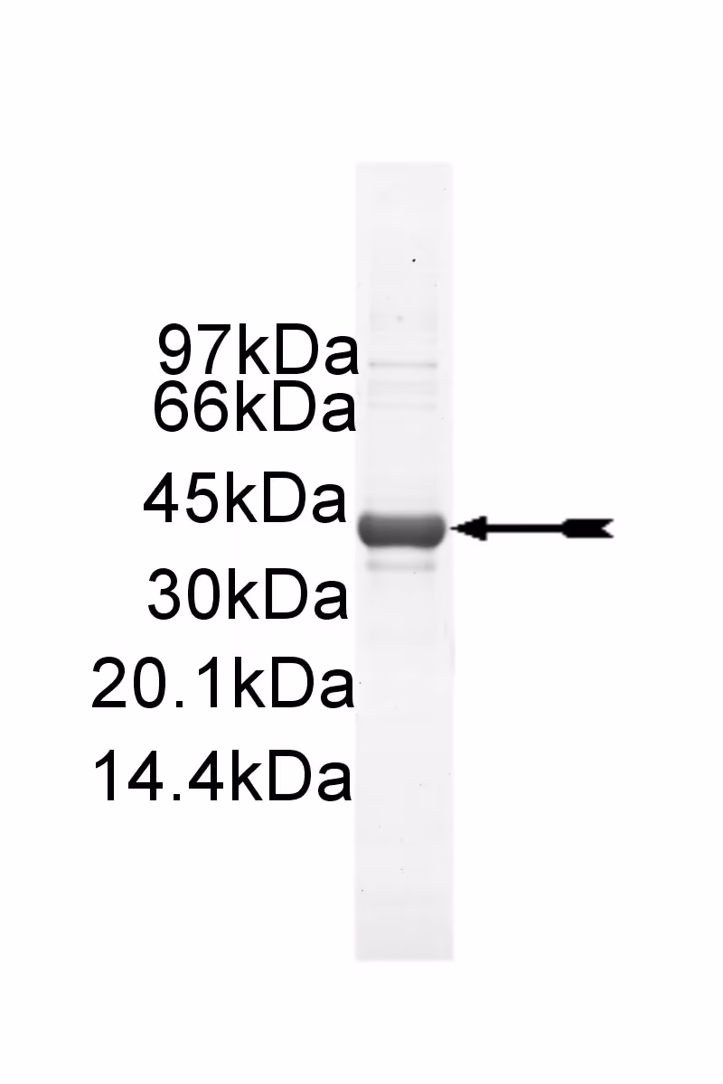 Casein Kinase 1γ1, active Human Recombinant Kinase Protein