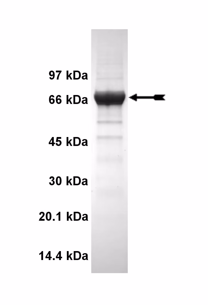 GRK5, active Human Recombinant Kinase Protein