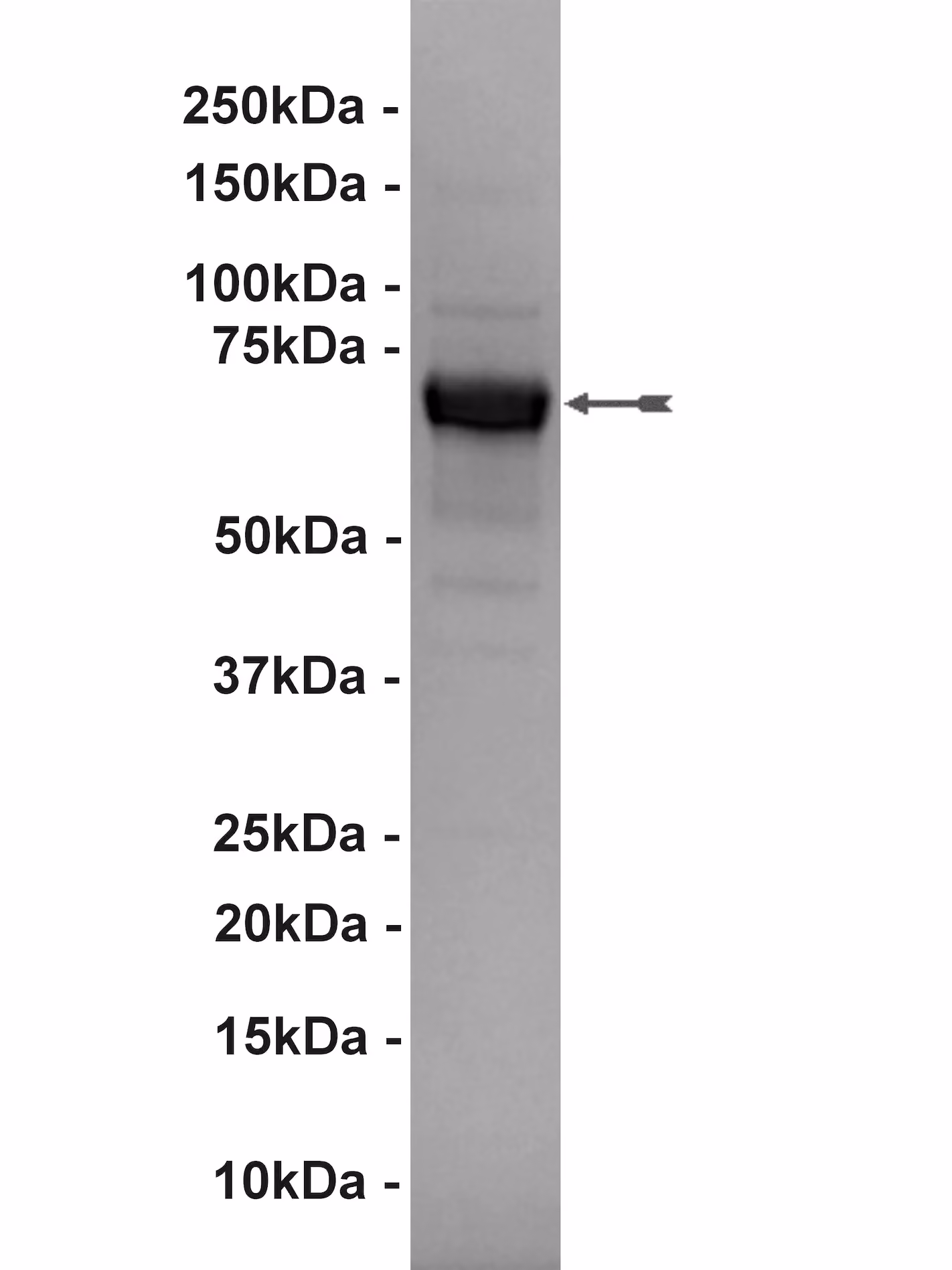 GRK6, active Human Recombinant Kinase Protein