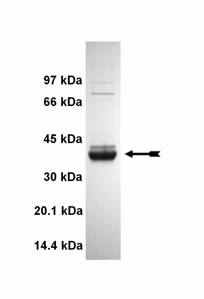 CaM Kinase IIγ, active Human Recombinant Kinase Protein