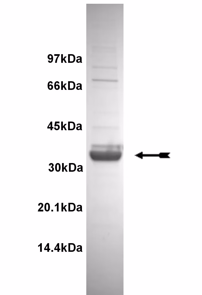 CaM Kinase IIβ, active Human Recombinant Kinase Protein