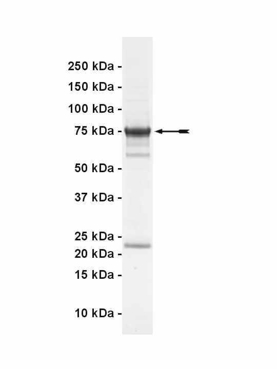 CaM Kinase I γ, active Human Recombinant Kinase Protein