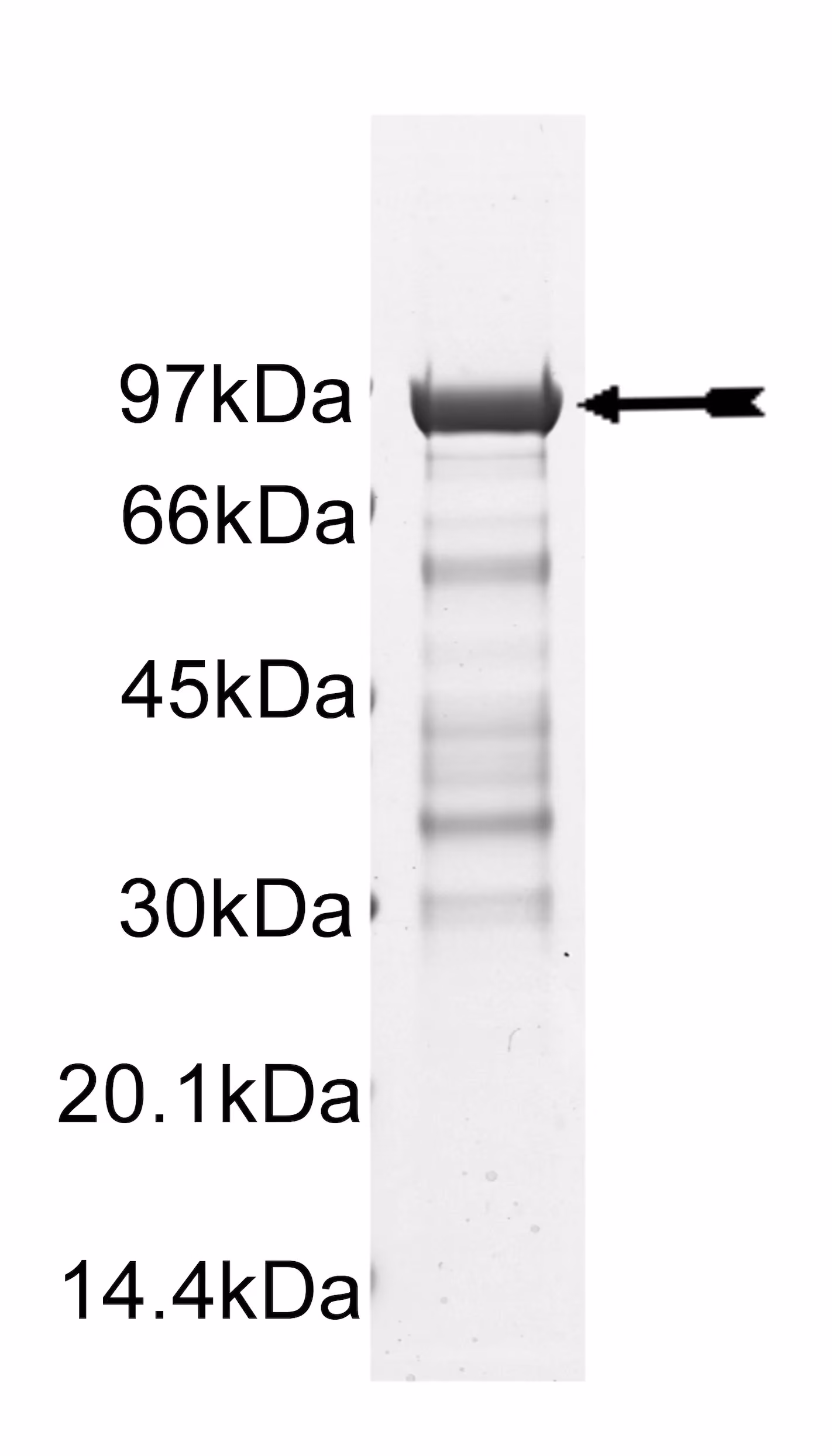 CHK2 (I157T), active Human Recombinant Kinase Protein