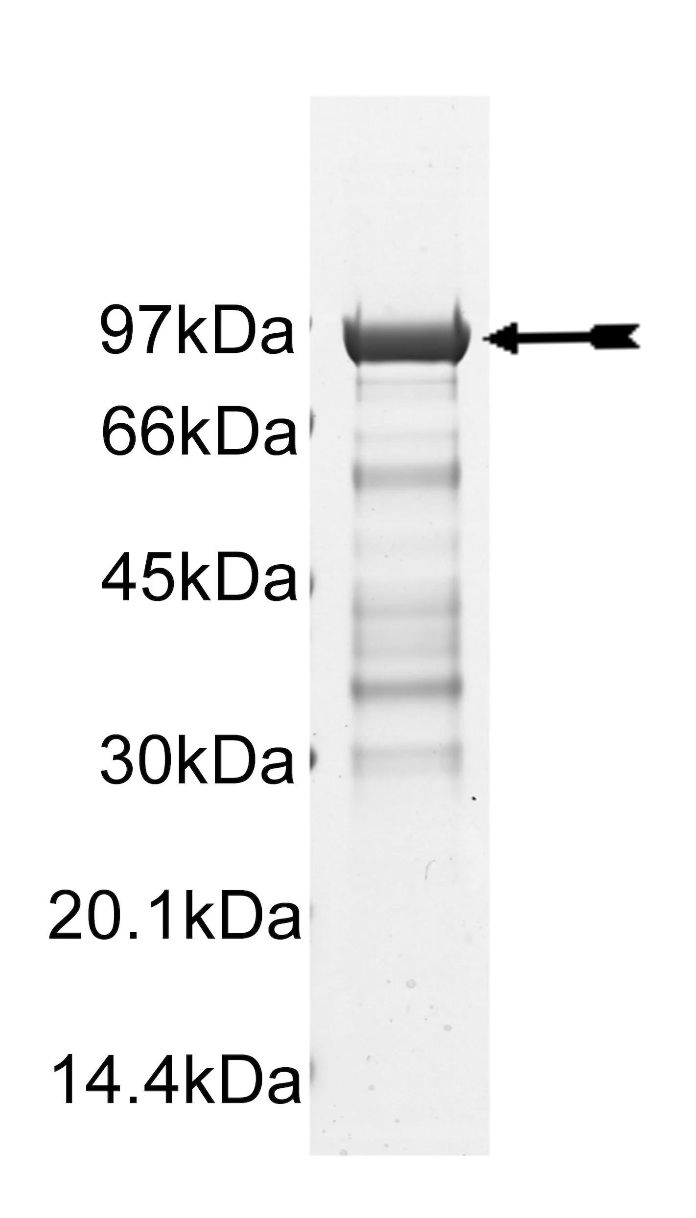 CHK2 (I157T), active Human Recombinant Kinase Protein