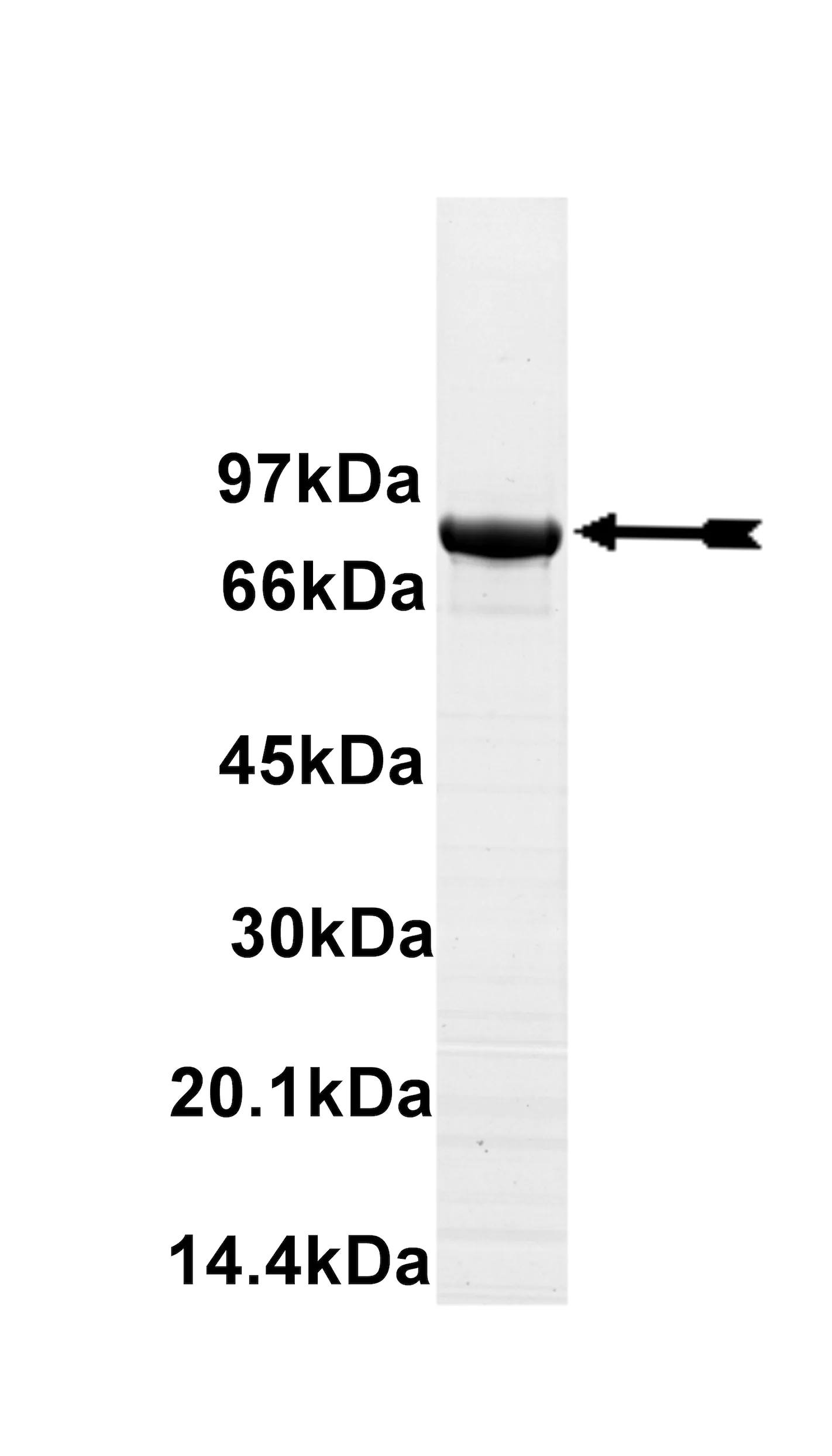 GCK, active Human Recombinant Kinase Protein