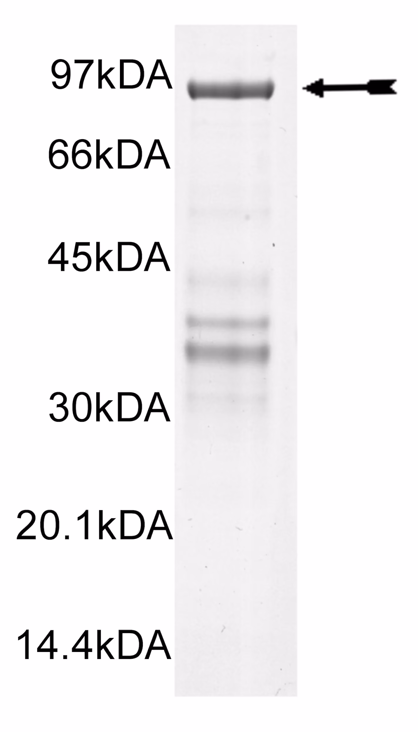 CHK2 (hu,5-end, R145W) Human Recombinant Kinase Protein