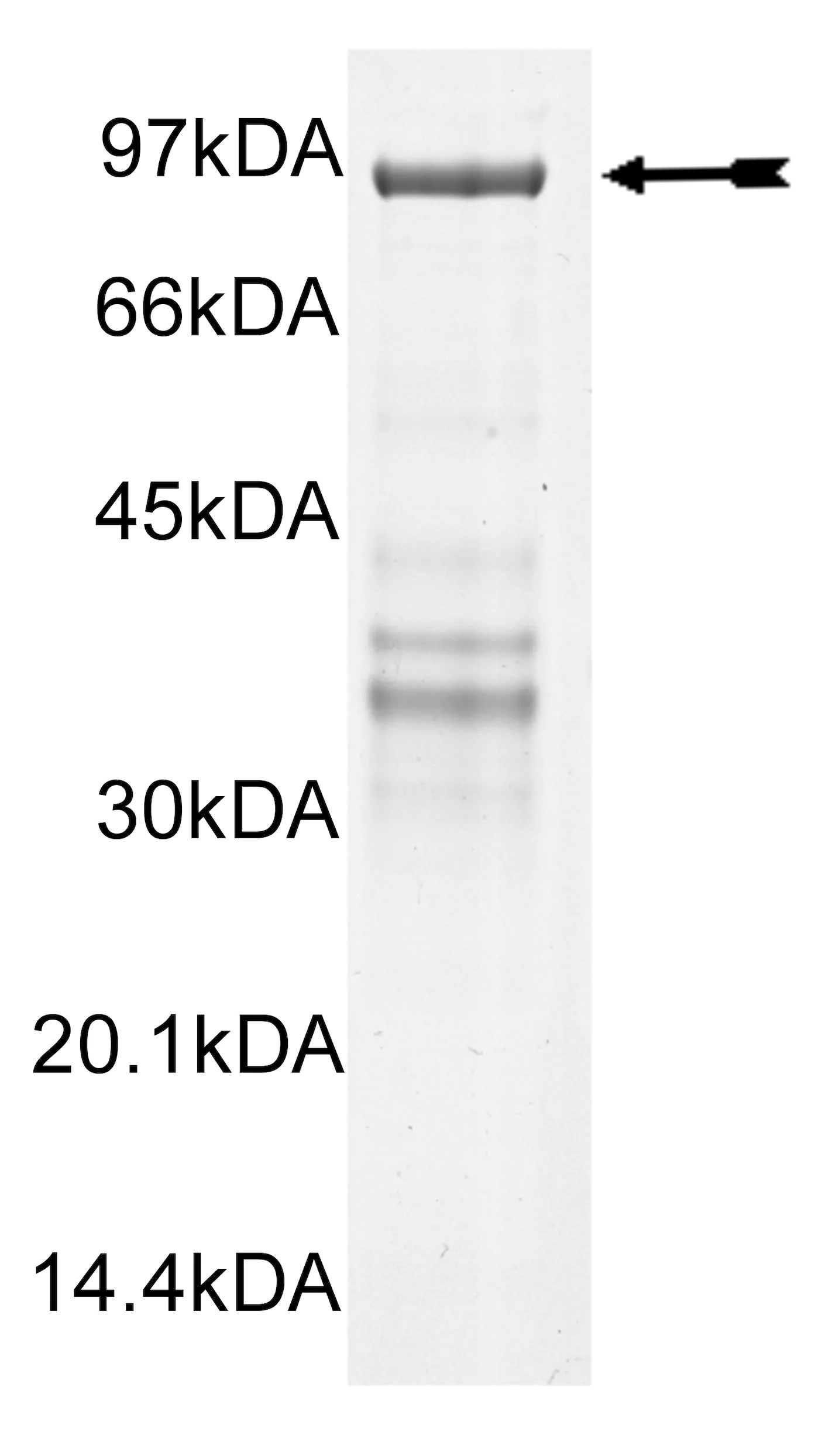 CHK2 (hu,5-end, R145W) Human Recombinant Kinase Protein