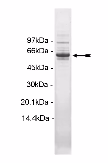 PIP5K1α, active Human Recombinant Kinase Protein