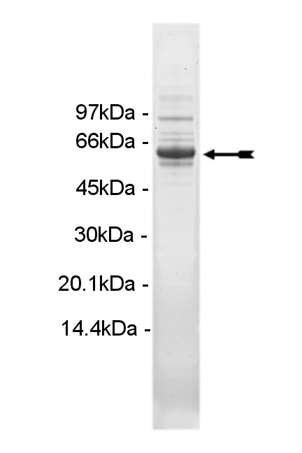 PIP5K1α, active Human Recombinant Kinase Protein