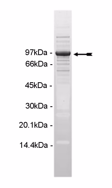 PIP5K1γ, active Human Recombinant Kinase Protein