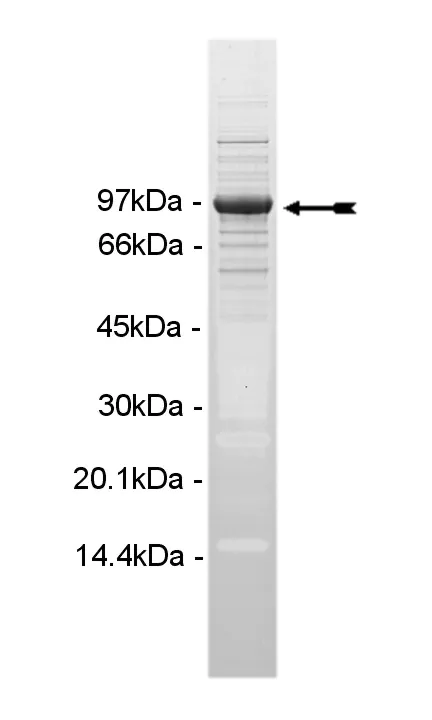 PIP5K1γ, active Human Recombinant Kinase Protein
