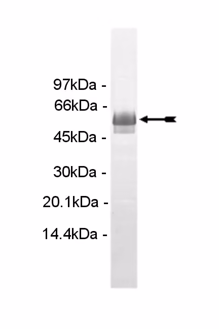 PIP4K2α, active Human Recombinant Kinase Protein
