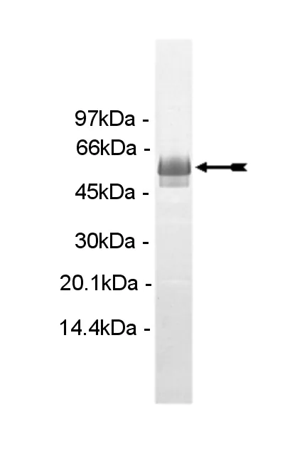 PIP4K2α, active Human Recombinant Kinase Protein