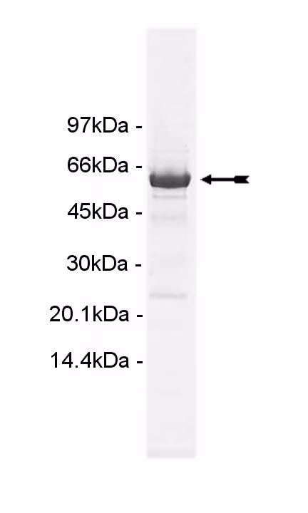 MELK, active Human Recombinant Kinase Protein