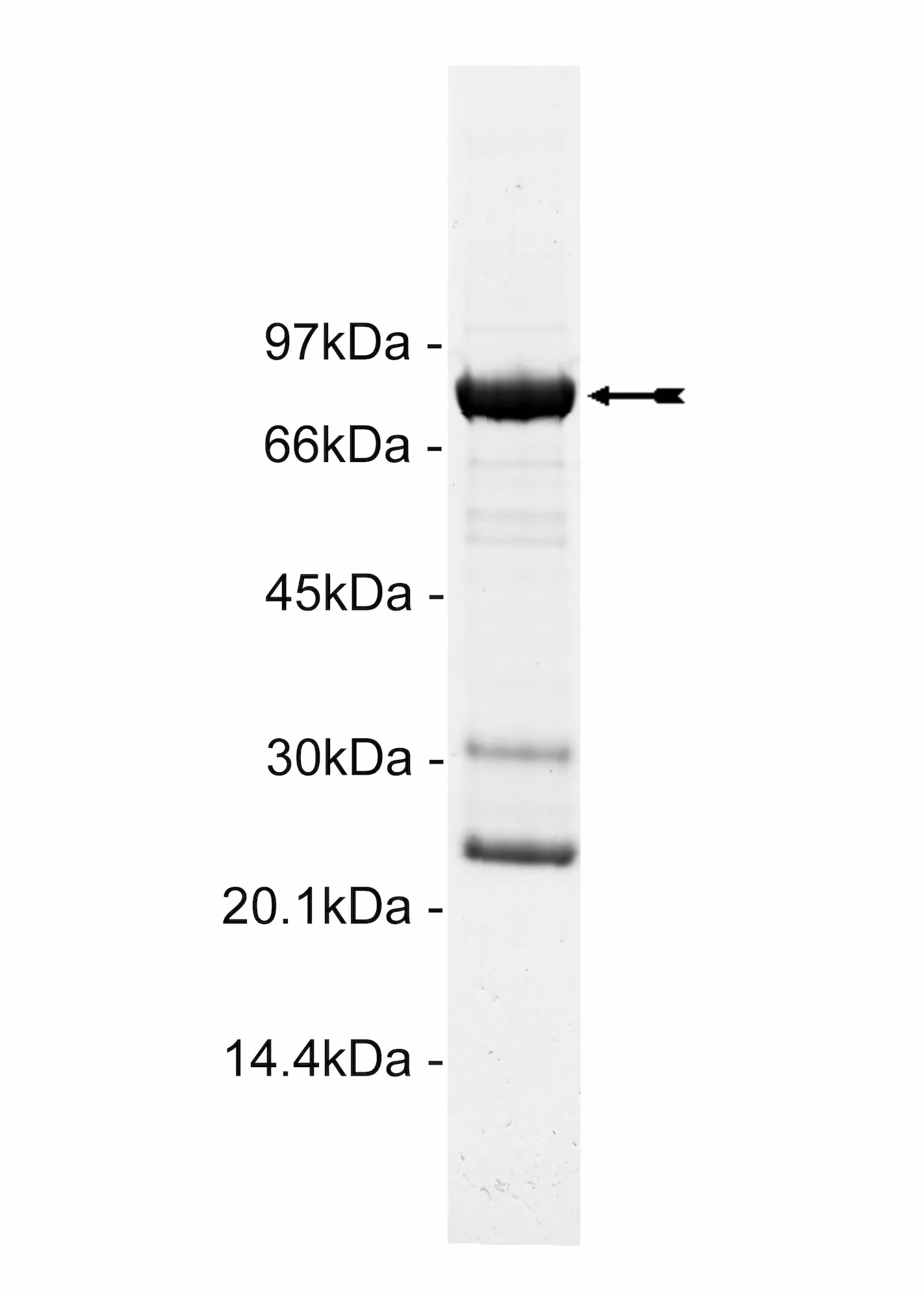 Ret (V804L), active Human Recombinant Kinase Protein