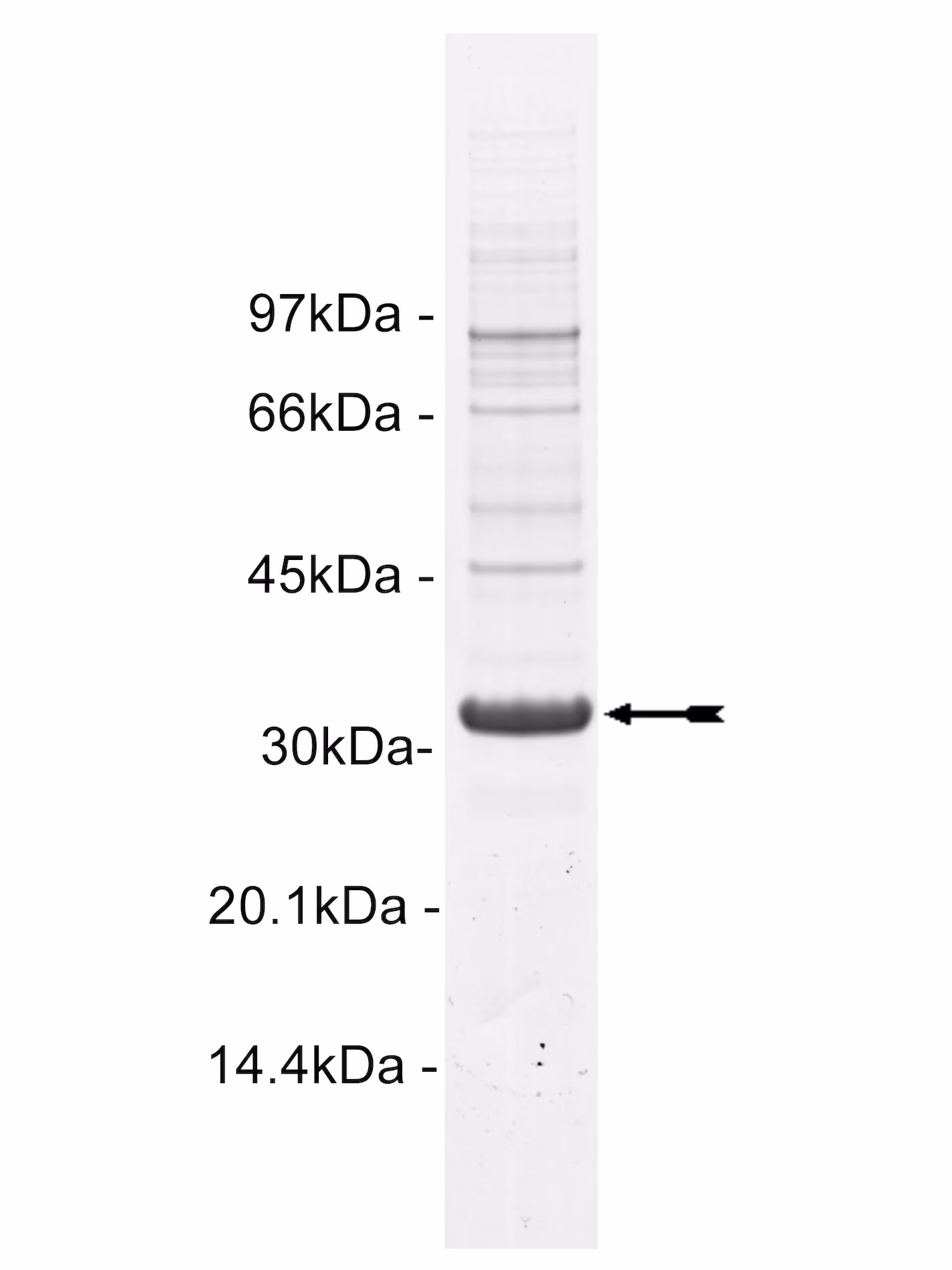 Txk, active Human Recombinant Kinase Protein