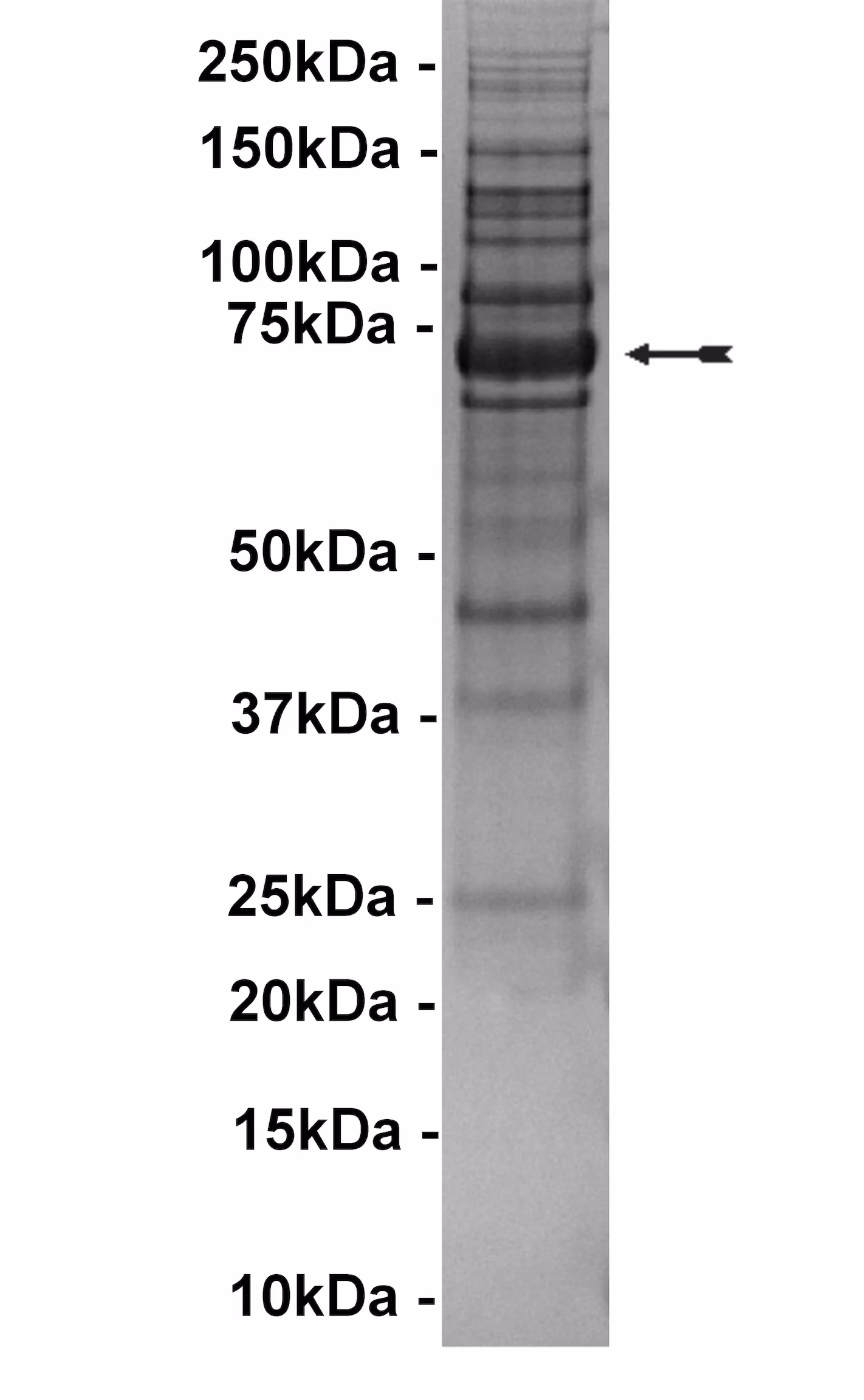 BTK (E41K), active Human Recombinant Kinase Protein
