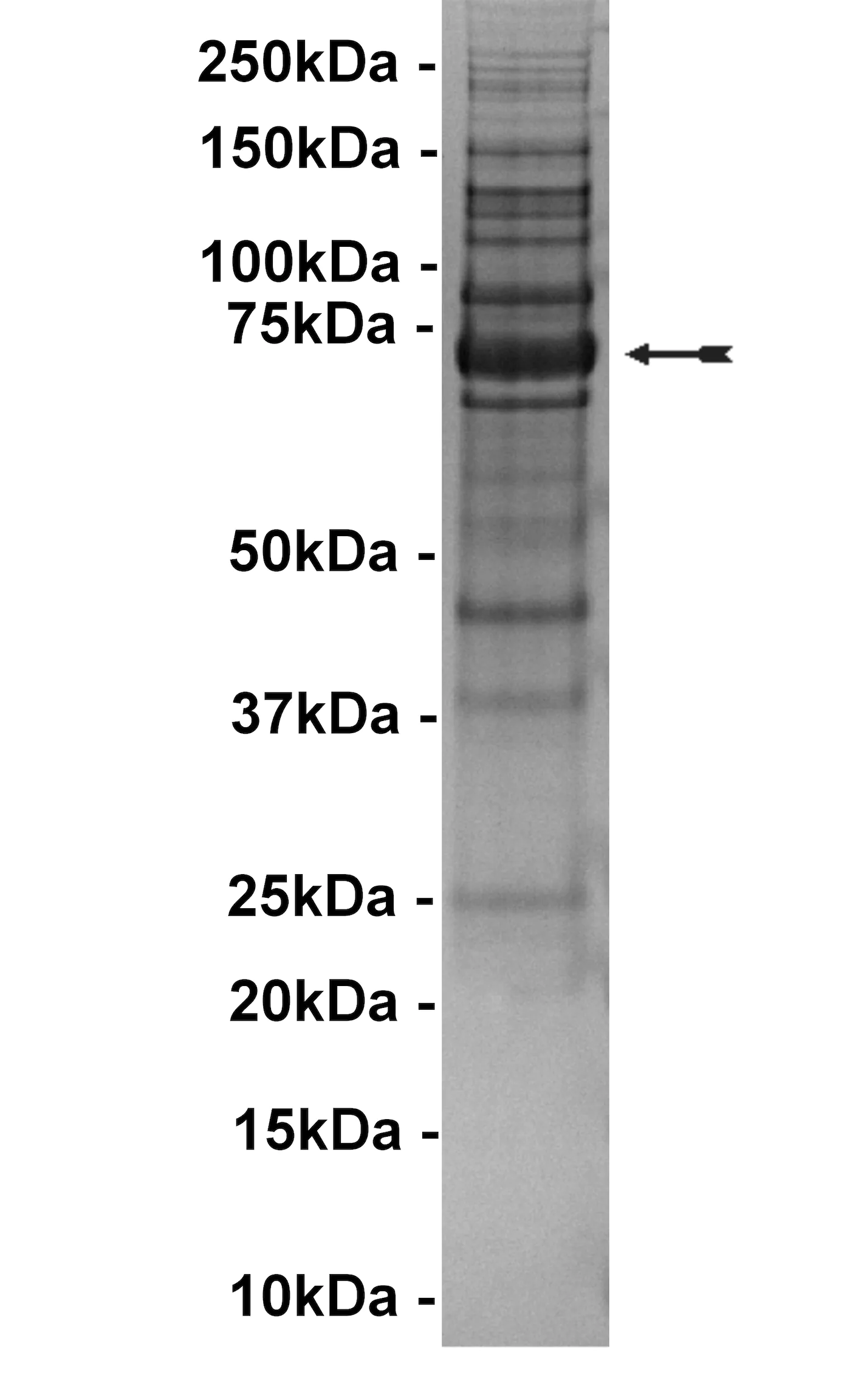 BTK (E41K), active Human Recombinant Kinase Protein