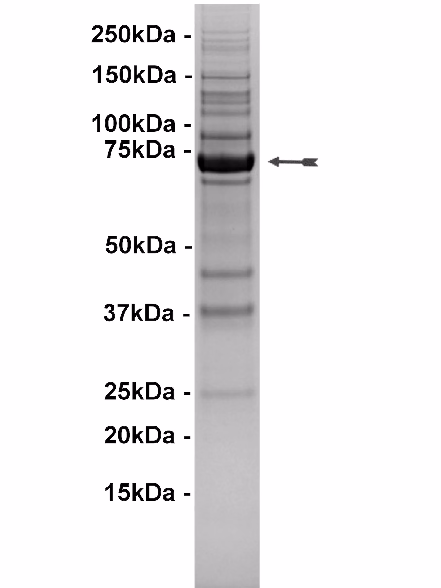 BTK (R28H), active Human Recombinant Kinase Protein