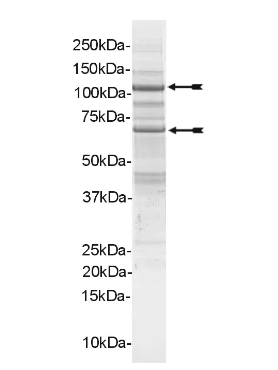 PI3 Kinase (p110α/p65α) Mouse Recombinant Kinase Protein