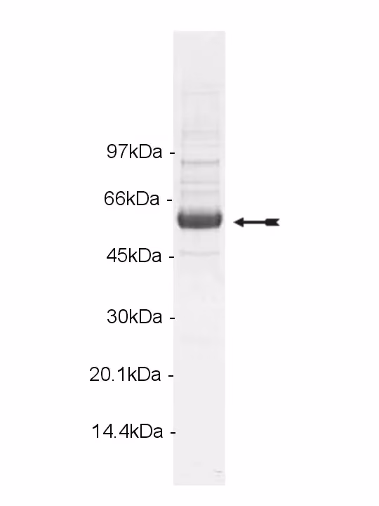 Lck, activated Human Recombinant Kinase Protein