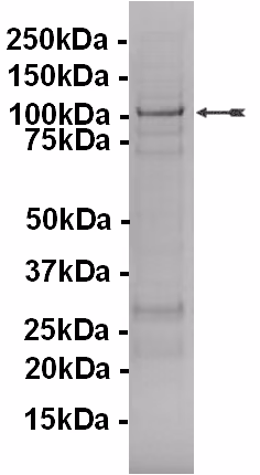 NUAK2, active Human Recombinant Kinase Protein