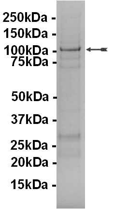 NUAK2, active Human Recombinant Kinase Protein