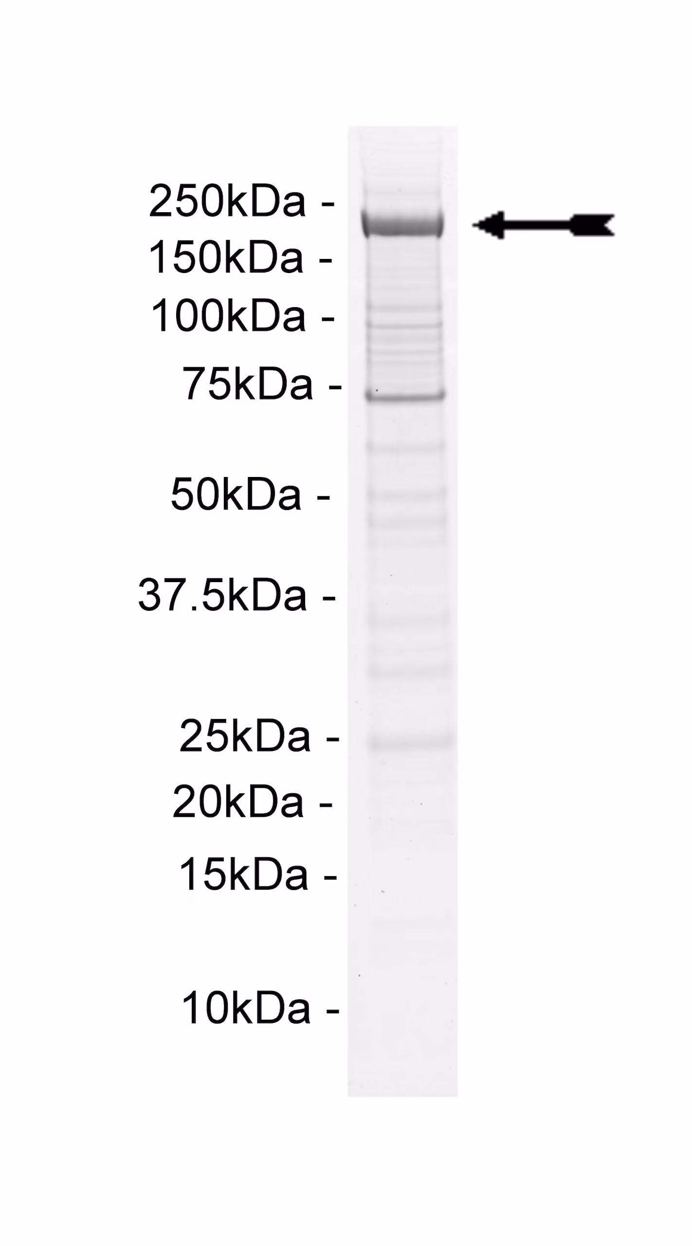 PI4KIIIα Human Recombinant Kinase Protein