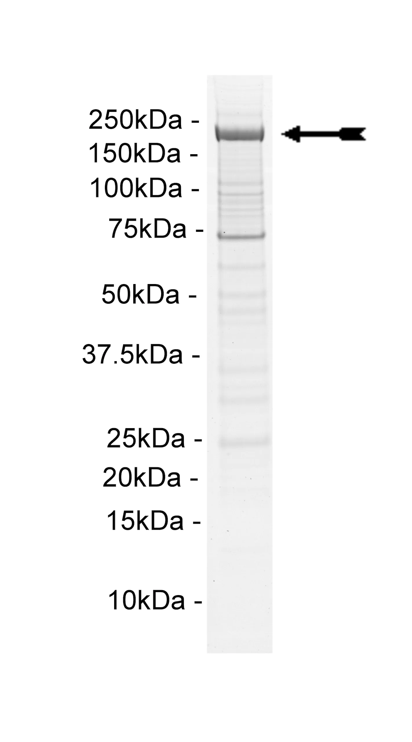 PI4KIIIα Human Recombinant Kinase Protein