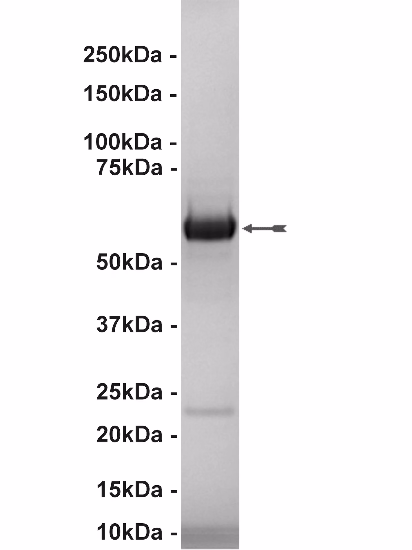 TGFBR-1, active Human Recombinant Kinase Protein