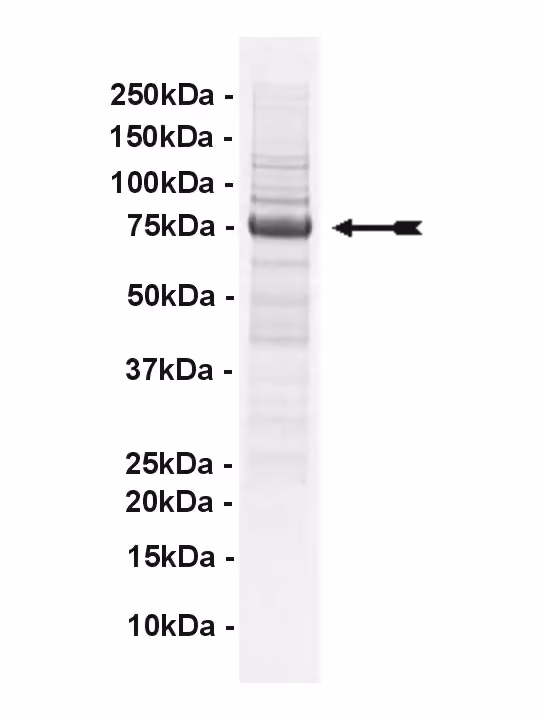 PEK, active Human Recombinant Kinase Protein